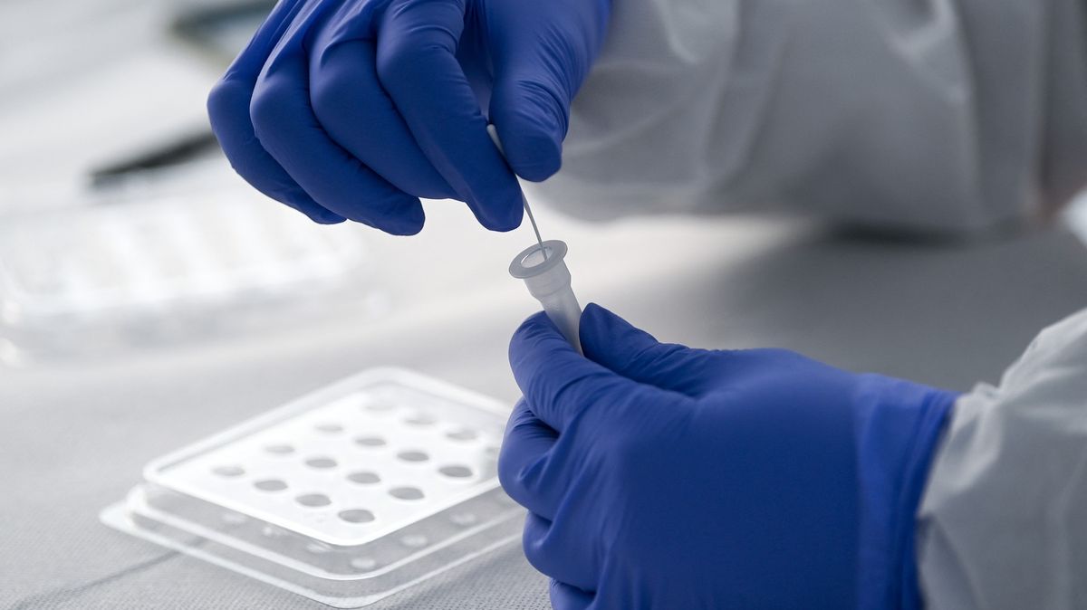 V Brazílii objevili novou mutaci. PCR testy ji ale neodhalí